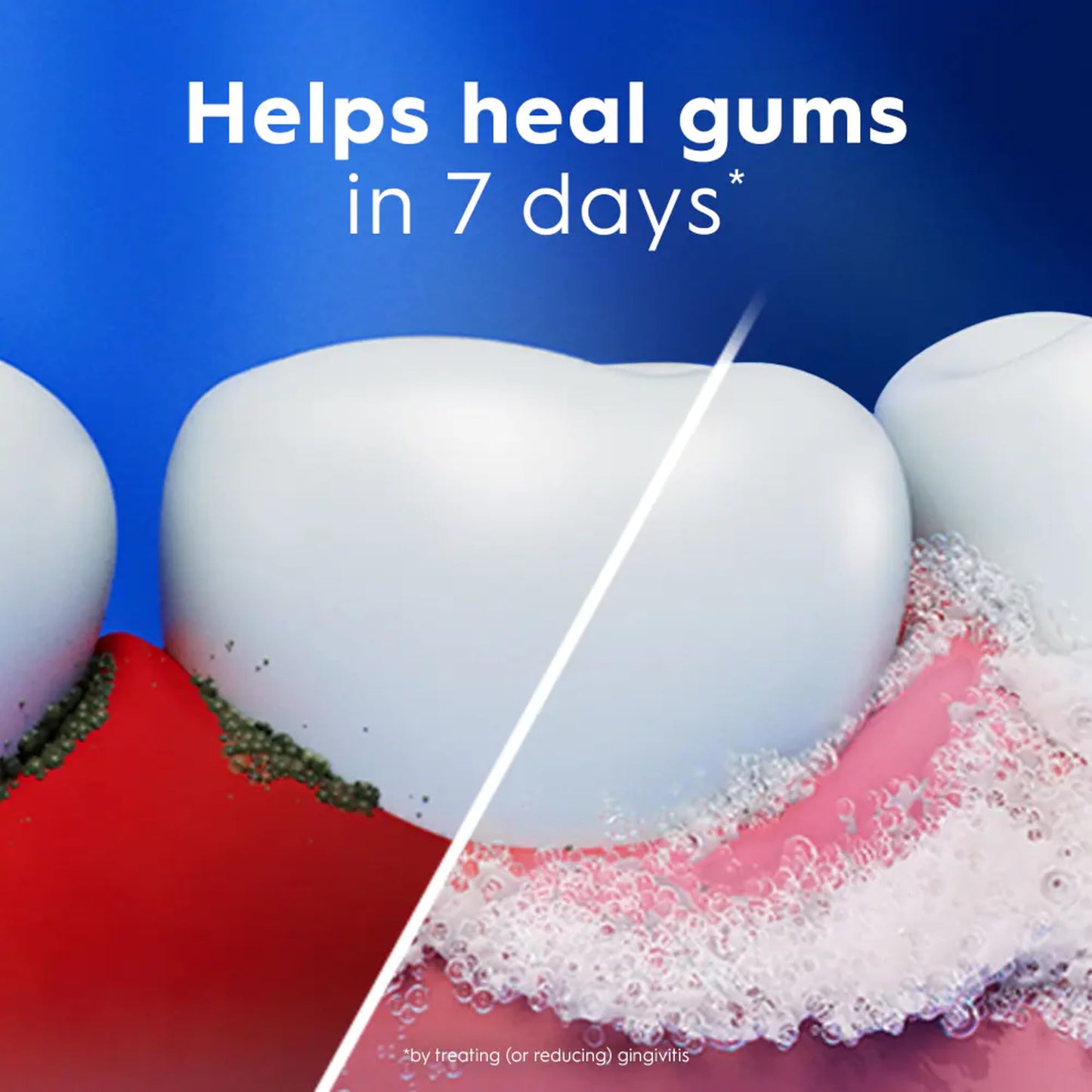 Crest Pro-Health Advanced Gum Care Toothpaste, Whitening, 4.8 Oz Large Size (Pack of 3)